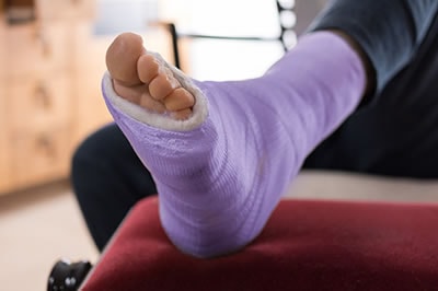 Foot and ankle fractures treatment in the Riverside County, CA: Murrieta (Temecula, Menifee, Lake Elsinore, French Valley, Wildomar, Lakeland, Village, Canyon Lake, Valle De Los Caballos) areas